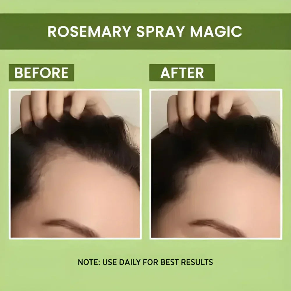 Rosemary Water Spray | For Hair Regrowth